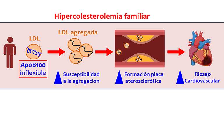 Un estudio liderado por el IIBB-CSIC y el CIBER demuestra que la estructura de la apolipoproteína ApoB100 de las lipoproteínas LDL influye en una mayor tendencia de estas para agregarse y formar placas de aterosclerosis en pacientes con hipercolesterolemi